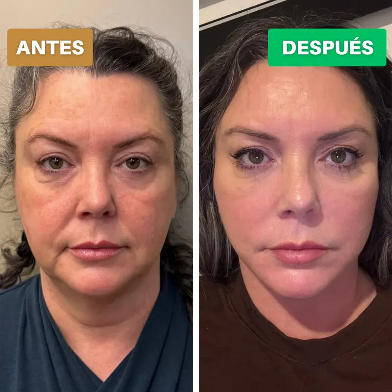 Cepillo Contorno Facial Linfatico 🇪🇸