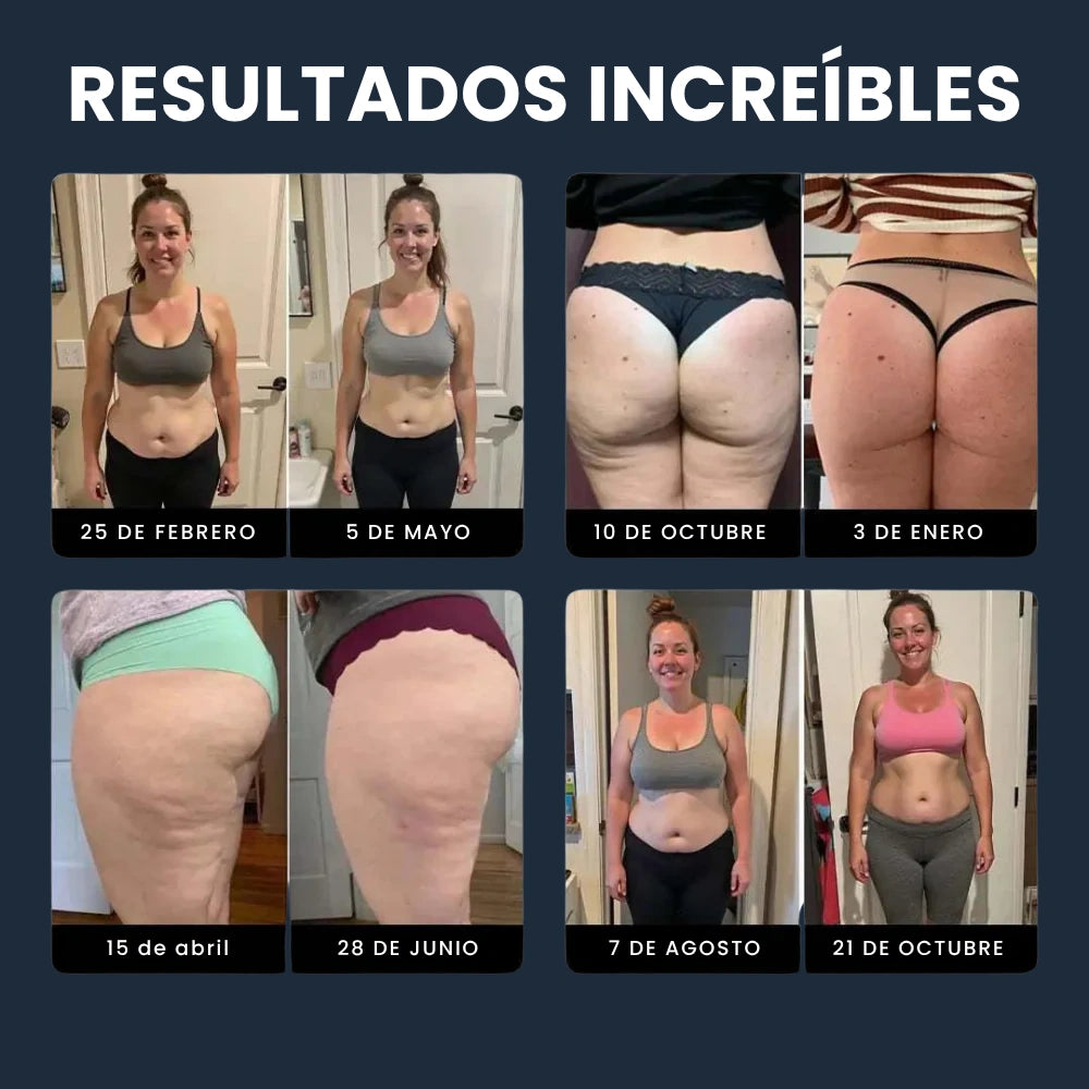 ShapeX 3D Leggings Anticelulíticos